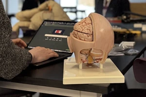 Student typing on a laptop computer next to a model of a human brain.