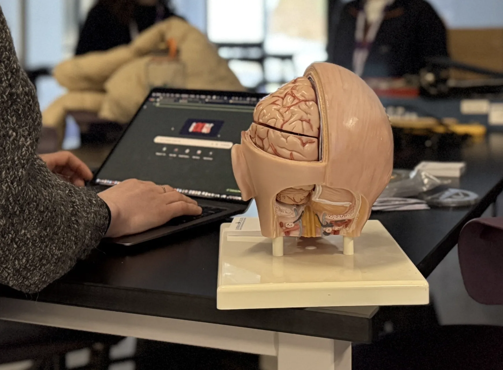 Student typing on a laptop computer next to a model of a human brain.